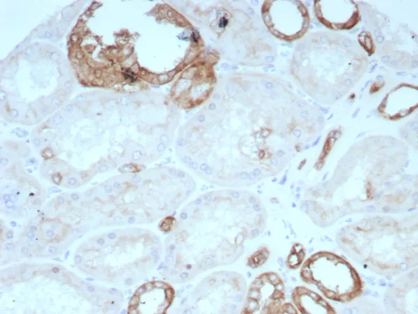 Formalin-fixed, paraffin-embedded human kidney stained with Occludin Recombinant Mouse Monoclonal Antibody (rOCLN/8776). HIER: Tris/EDTA, pH9.0, 45min. 2°C: HRP-polymer, 30min. DAB, 5min.