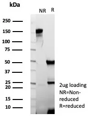 SDS-PAGE Analysis of Purified Occludin Recombinant Mouse Monoclonal Antibody (rOCLN/8525). Confirmation of Purity and Integrity of Antibody.
