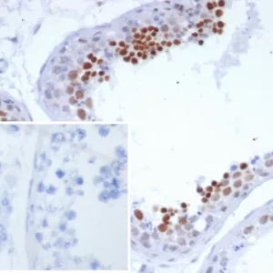 Formalin-fixed, paraffin-embedded human testis stained with NUTM1 Recombinant Rabbit Monoclonal Antibody (SNUPN/7351R). Inset: PBS instead of primary antibody; secondary only negative control.