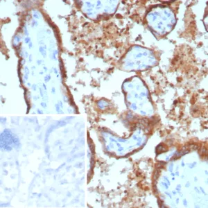 Formalin-fixed, paraffin-embedded human placenta stained with Epstein-Barr virus induced 3 Mouse Monoclonal Antibody (EBI3/8902). Inset: PBS instead of primary antibody; secondary only negative control.