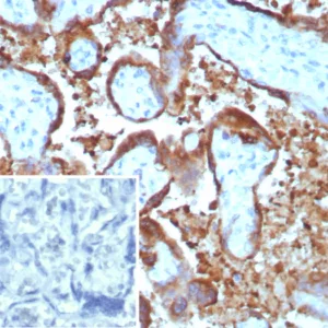 Formalin-fixed, paraffin-embedded human placenta stained with Epstein-Barr virus induced 3 Mouse Monoclonal Antibody (EBI3/8903). Inset: PBS instead of primary antibody; secondary only negative control.