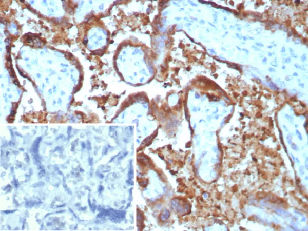 Formalin-fixed, paraffin-embedded human placenta stained with Epstein-Barr virus induced 3 Mouse Monoclonal Antibody (EBI3/8903). Inset: PBS instead of primary antibody; secondary only negative control.