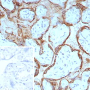 Formalin-fixed, paraffin-embedded human placenta stained with Epstein-Barr virus induced 3 Mouse Monoclonal Antibody (EBI3/8904). Inset: PBS instead of primary antibody; secondary only negative control.