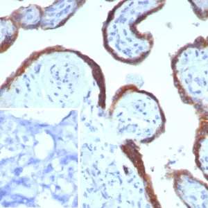 Formalin-fixed, paraffin-embedded human placenta stained with Epstein-Barr virus induced 3 Mouse Monoclonal Antibody (EBI3/8905). Inset: PBS instead of primary antibody; secondary only negative control.