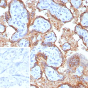 Formalin-fixed, paraffin-embedded human placenta stained with Epstein-Barr virus induced 3 Mouse Monoclonal Antibody (EBI3/8906). Inset: PBS instead of primary antibody; secondary only negative control.
