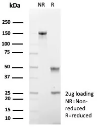 SDS-PAGE Analysis of Purified CDH17 Recombinant Mouse Monoclonal Antibody (rCDH17/8512). Confirmation of Purity and Integrity of Antibody.