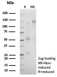 SDS-PAGE Analysis of Purified CDH17 Recombinant Mouse Monoclonal Antibody (rCDH17/8514). Confirmation of Purity and Integrity of Antibody.