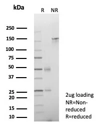 SDS-PAGE Analysis of Purified CDH17 Recombinant Rabbit Monoclonal Antibody (CDH17/8513R). Confirmation of Purity and Integrity of Antibody.