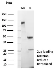 SDS-PAGE Analysis of Purified CDH17 Recombinant Rabbit Monoclonal Antibody (CDH17/8515R). Confirmation of Purity and Integrity of Antibody.