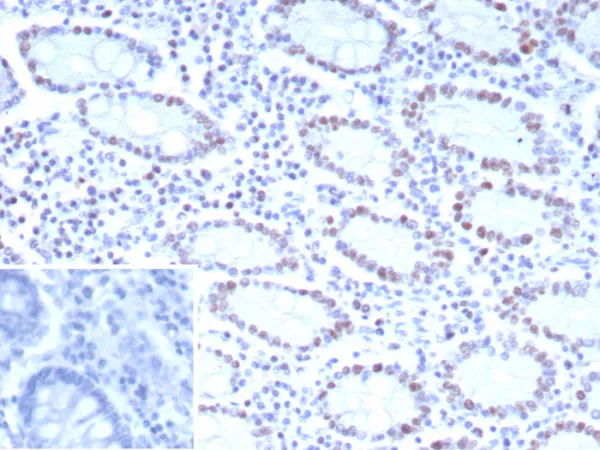 Formalin-fixed, paraffin-embedded human colon stained with  CDK4 Mouse Monoclonal Antibody (CDK4/8895). Inset: PBS instead of primary antibody; secondary only negative control.