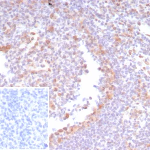 Formalin-fixed, paraffin-embedded human tonsil stained with  CDK4 Recombinant Rabbit Monoclonal Antibody (CDK4/8210R). Inset: PBS instead of primary antibody; secondary only negative control.
