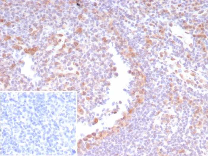Formalin-fixed, paraffin-embedded human tonsil stained with CDK4 Recombinant Rabbit Monoclonal Antibody (CDK4/8210R). Inset: PBS instead of primary antibody; secondary only negative control. Recombinant CDK4 Antibody
