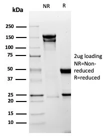 SDS-PAGE Analysis of Purified Mesothelin Recombinant Rabbit Monoclonal Ab (MSLN/6443R). Confirmation of Integrity and Purity of the Antibody.