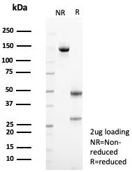 SDS-PAGE Analysis of Purified Mesothelin Recombinant Rabbit Monoclonal Ab (MSLN/8391R). Confirmation of Integrity and Purity of the Antibody.