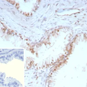 IHC analysis of formalin-fixed, paraffin-embedded human prostate.  Strong nuclear staining using KIP1/9168R at 2ug/ml in PBS for 30min RT. HIER: Tris/EDTA, pH9.0, 45min. 2°C: HRP-polymer, 30min. DAB, 5min.