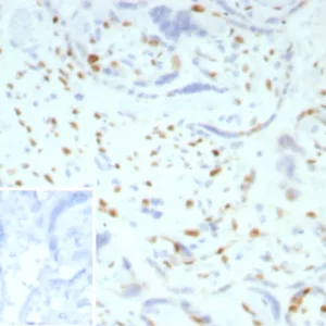 IHC analysis of formalin-fixed, paraffin-embedded human placenta  p57 Mouse Monoclonal Antibody (KIP2/7186). Inset: PBS instead of primary antibody; secondary only negative control.
