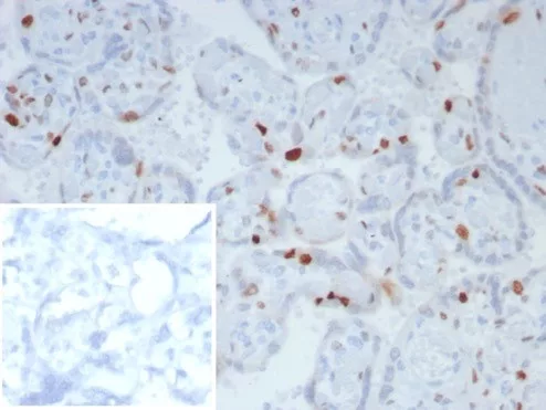 IHC analysis of formalin-fixed, paraffin-embedded human placenta.  Strong nuclear staining using KIP2/8169R at 2ug/ml in PBS for 30min RT. Inset: PBS instead of primary antibody; secondary only negative control.