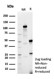 SDS-PAGE Analysis of Purified p57 Rabbit Recombinant Monoclonal Antibody (KIP2/8169R). Confirmation of Purity and Integrity of Antibody.