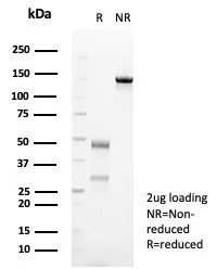SDS-PAGE Analysis of Purified TUBB3 Recombinant Mouse Monoclonal Antibody (rTUBB3/7406). Confirmation of Purity and Integrity of Antibody.