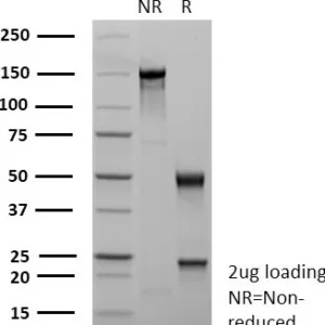 SDS-PAGE Analysis of Purified CDX2 Recombinant Mouse Monoclonal Antibody (rCDX2/9241). Confirmation of Purity and Integrity of Antibody.