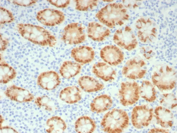 Formalin-fixed, paraffin-embedded human colon stained with CDX2 Recombinant Mouse Monoclonal Antibody (rCDX2/9241). HIER: Tris/EDTA, pH9.0, 45min. 2°C: HRP-polymer, 30min. DAB, 5min.