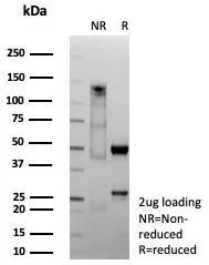 SDS-PAGE Analysis of Purified CDX2 Recombinant Mouse Monoclonal Antibody (CDX2/9298R). Confirmation of Purity and Integrity of Antibody.