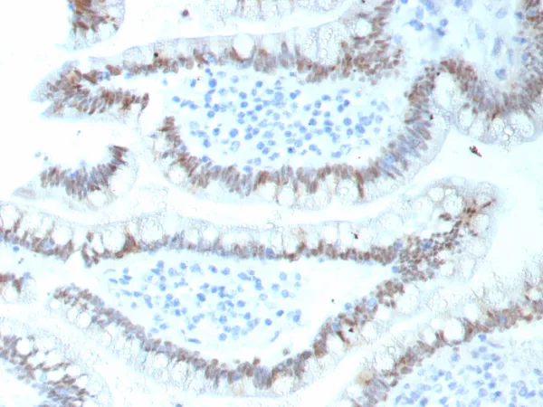 Formalin-fixed, paraffin-embedded human colon stained with CDX2 Recombinant Mouse Monoclonal Antibody (CDX2/9298R). HIER: Tris/EDTA, pH9.0, 45min. 2°C: HRP-polymer, 30min. DAB, 5min.