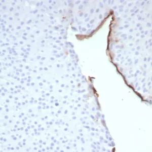 Formalin-fixed, paraffin-embedded human bladder stained with Uroplakin 3B Recombinant Rabbit Monoclonal Antibody (UPK3B/8768R). HIER: Tris/EDTA, pH9.0, 45min. 2°C: HRP-polymer, 30min. DAB, 5min.
