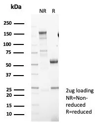SDS-PAGE Analysis of Purified DRAP1 Mouse Monoclonal Antibody (PCRP-DRAP1-1A12) Confirmation of Purity and Integrity of Antibody. DRAP1 / NC2 alpha Antibody - Image 2