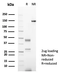 SDS-PAGE Analysis of Purified Secretagogin (SCGN) Mouse Monoclonal Antibody (SCGN/7321). Confirmation of Purity and Integrity of Antibody.