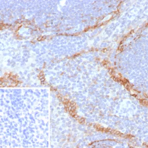 Formalin-fixed, paraffin-embedded human tonsil stained with Podoplanin Recombinant Mouse Monoclonal Antibody (rPDPN/6994). Inset: PBS instead of primary antibody; secondary only negative control.