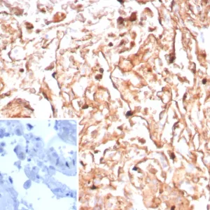 Formalin-fixed, paraffin-embedded human tonsil stained with Podoplanin Recombinant Rabbit Monoclonal Antibody (PDPN/8950R). Inset: PBS instead of primary antibody; secondary only negative control.