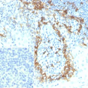Formalin-fixed, paraffin-embedded human tonsil stained with Podoplanin Recombinant Rabbit Monoclonal Antibody (PDPN/7808R). Inset: PBS instead of primary antibody; secondary only negative control.