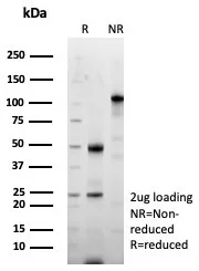 SDS-PAGE Analysis of Purified Periostin Recombinant Rabbit Monoclonal Antibody (POSTN/8523R). Confirmation of Purity and Integrity of Antibody.