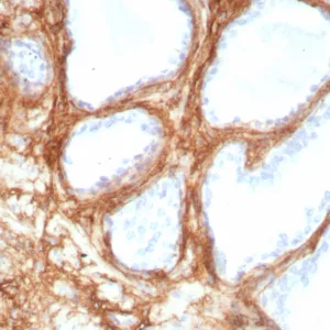 Formalin-fixed, paraffin-embedded human lung stained with Periostin Recombinant Rabbit Monoclonal Antibody (POSTN/8951R). HIER: Tris/EDTA, pH9.0, 45min. 2°C: HRP-polymer, 30min. DAB, 5min.