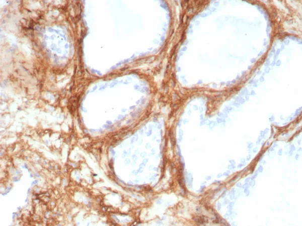 Formalin-fixed, paraffin-embedded human lung stained with Periostin Recombinant Rabbit Monoclonal Antibody (POSTN/8951R). HIER: Tris/EDTA, pH9.0, 45min. 2°C: HRP-polymer, 30min. DAB, 5min.
