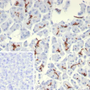 IHC analysis of formalin-fixed, paraffin-embedded human pancreas.  CFTR Recombinant Mouse Monoclonal Antibody (rCFTR/8047). Inset: PBS instead of primary antibody; secondary only negative control.