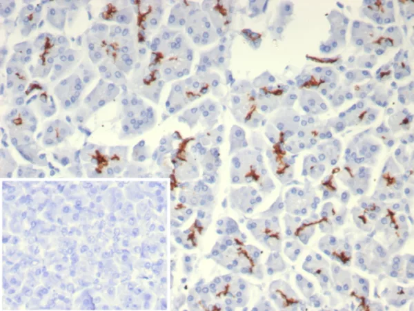 IHC analysis of formalin-fixed, paraffin-embedded human pancreas.  CFTR Recombinant Mouse Monoclonal Antibody (rCFTR/8047). Inset: PBS instead of primary antibody; secondary only negative control.