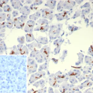 IHC analysis of formalin-fixed, paraffin-embedded human pancreas.  CFTR Recombinant Mouse Monoclonal Antibody (rCFTR/8048). Inset: PBS instead of primary antibody; secondary only negative control.
