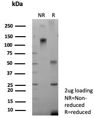 SDS-PAGE Analysis of Purified CFTR Recombinant Rabbit Monoclonal Antibody (CFTR/9148R).  Confirmation of Purity and Integrity of Antibody.
