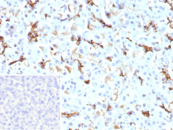 IHC analysis of formalin-fixed, paraffin-embedded human pancreas.  CFTR Recombinant Rabbit Monoclonal Antibody (CFTR/9148R) at 2ug/ml. Inset: PBS instead of primary antibody; secondary only negative control.
