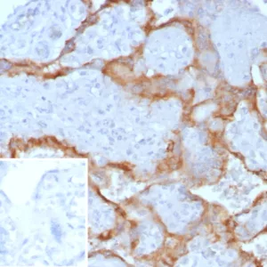 Formalin-fixed, paraffin-embedded human placenta stained with HCG-beta Mouse Monoclonal Antibody (hCGa/7872). Inset: PBS instead of primary antibody; secondary only negative control.