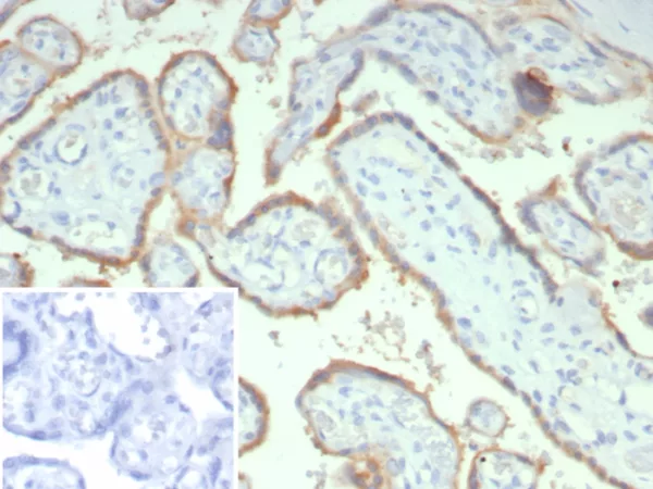 Formalin-fixed, paraffin-embedded human placenta stained with HCG-beta Mouse Monoclonal Antibody (hCGa/7873). Inset: PBS instead of primary antibody; secondary only negative control.