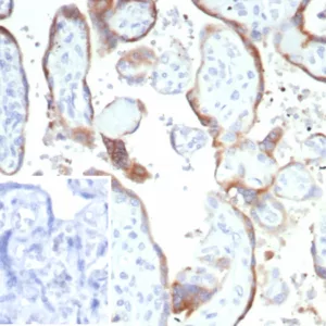 Formalin-fixed, paraffin-embedded human placenta stained with HCG-beta Mouse Monoclonal Antibody (hCGa/7874). Inset: PBS instead of primary antibody; secondary only negative control.