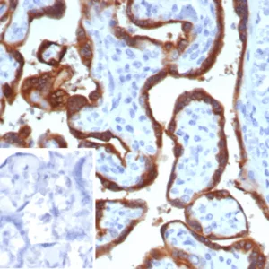 Formalin-fixed, paraffin-embedded human placenta stained with HCG-beta Mouse Monoclonal Antibody (hCGa/7875). Inset: PBS instead of primary antibody; secondary only negative control.