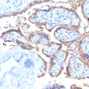 Formalin-fixed, paraffin-embedded human placenta stained with HCG-beta Recombinant Mouse Monoclonal Antibody (rHCGa/6975). Inset: PBS instead of primary antibody; secondary only negative control.