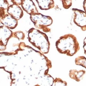Formalin-fixed, paraffin-embedded human placenta stained with HCG-beta Mouse Monoclonal Antibody (hCGa/7138). HIER: Tris/EDTA, pH9.0, 45min. 2: HRP-polymer, 30min. DAB, 5min.