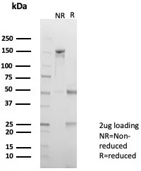 SDS-PAGE Analysis of Purified ADH1L1 Mouse Monoclonal Antibody (ALDH1L1/7701). Confirmation of Purity and Integrity of Antibody.