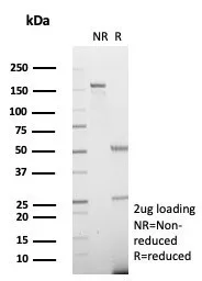 SDS-PAGE Analysis of Purified ADH1L1 Mouse Monoclonal Antibody (ALDH1L1/7702). Confirmation of Purity and Integrity of Antibody.