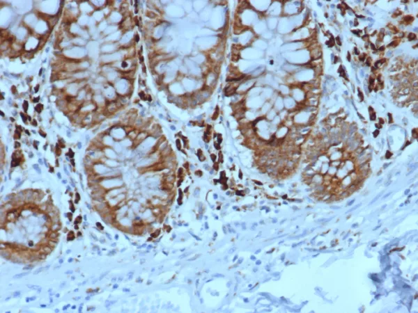 Formalin-fixed, paraffin-embedded human colon stained with ADH1L1 Mouse Monoclonal Antibody (ALDH1L1/7702). HIER: Tris/EDTA, pH9.0, 45min. 2°C: HRP-polymer, 30min. DAB, 5min.
